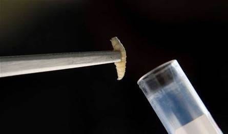 After recording the first human injury in America .. What do we know about spiral worm disease?