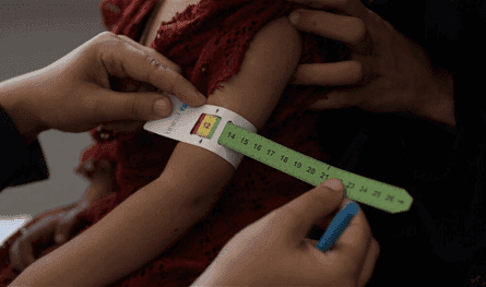 The Palestinians cannot escape starvation