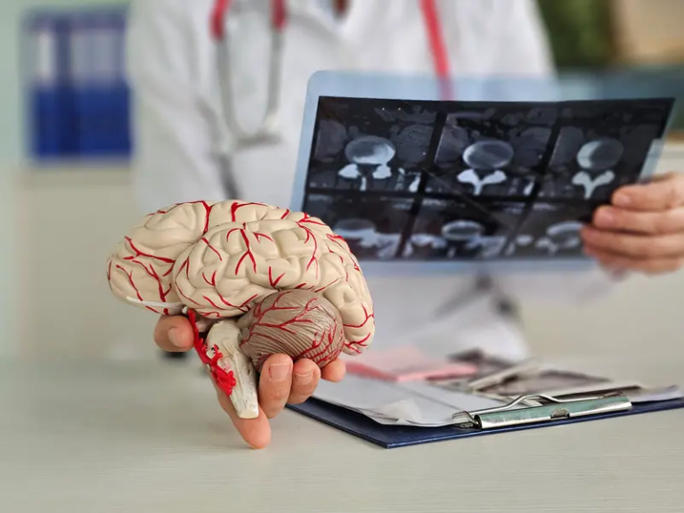 Alzheimer’s Protein Found to Boost the Body’s Ability to Fight Cancer