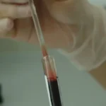 A rare disease that affects young people confuses doctors.. What are its details?