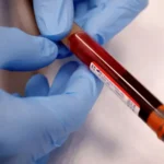 A single blood test: Does it hold the key to detecting Alzheimer’s?