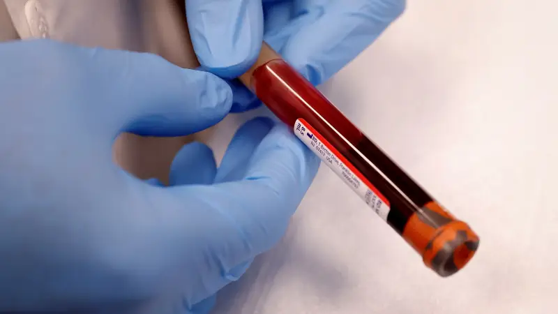 A single blood test: Does it hold the key to detecting Alzheimer’s?