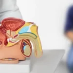 Plastic in the prostate gland: surprising results raise serious concerns