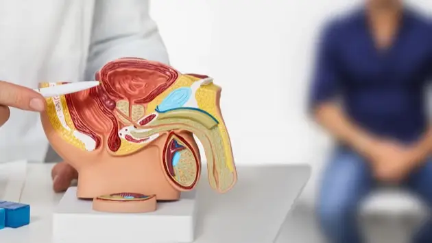 Plastic in the prostate gland: surprising results raise serious concerns