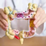 South Korea: Discovering a new mechanism to combat colon cancer