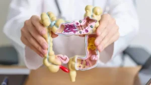 South Korea: Discovering a new mechanism to combat colon cancer