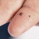 A recent study casts doubt on the link between tick bites and chronic diseases