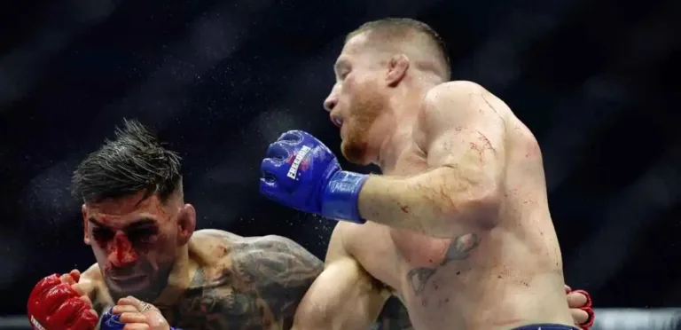 Serious injuries keep Topuria out of fighting until 2026 after a tough loss in the UFC
