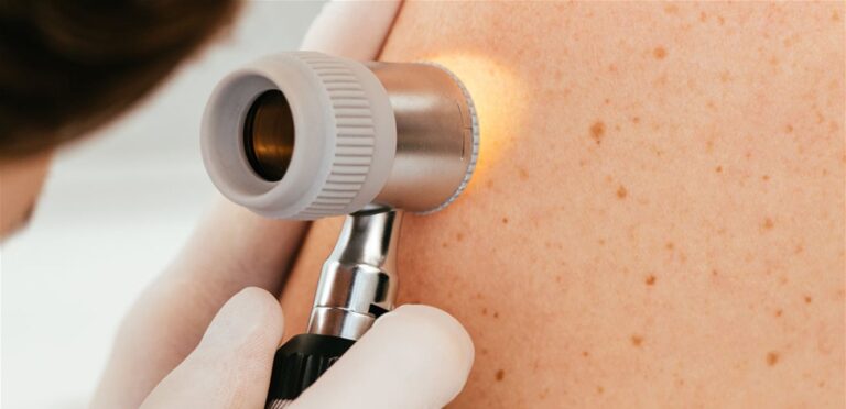 An application that detects “the most dangerous skin cancers”. Find out the details
