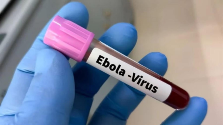 A doctor transmits Ebola… What are the measures in Lebanon?