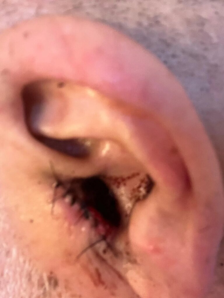 A foreign tourist leaves Lebanon injured after his ear was amputated in mysterious circumstances
